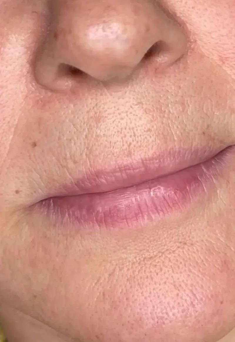 Estética Avançada em Guarulhos
