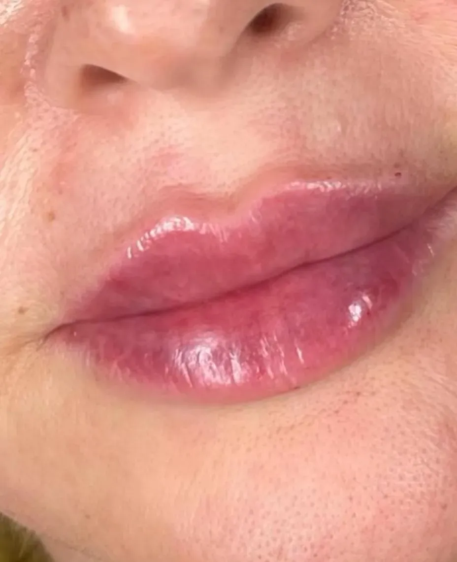 Estética natural em Guarulhos
